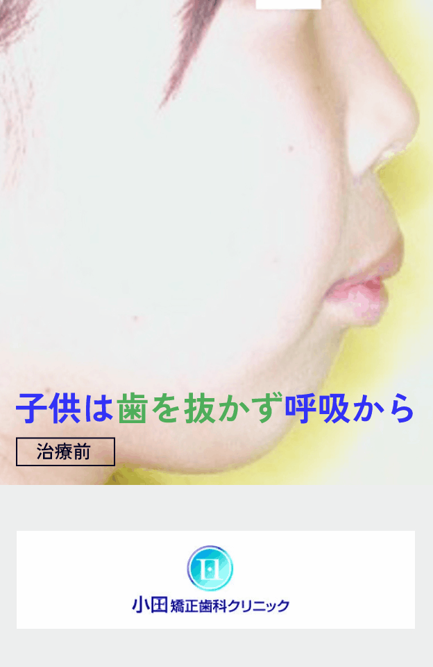 モバイル用gifアニメ画像1